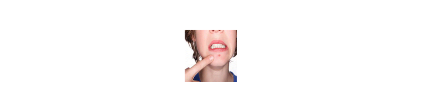 Traitement contre l'acné  - Parapharmacie en ligne